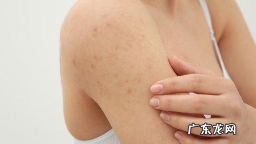 阿莫西林能和头孢共用吗