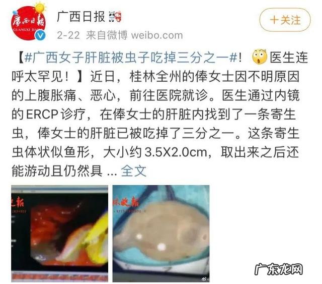 女子体内为何出现肝巨片型吸虫?