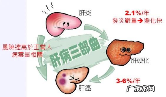 怎么才能不运动消除脂肪肝