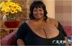 世界上最大的天然乳房 安妮·霍金斯·特纳双乳重达35.8公斤