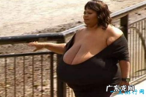 世界上最大的天然乳房 安妮·霍金斯·特纳双乳重达35.8公斤