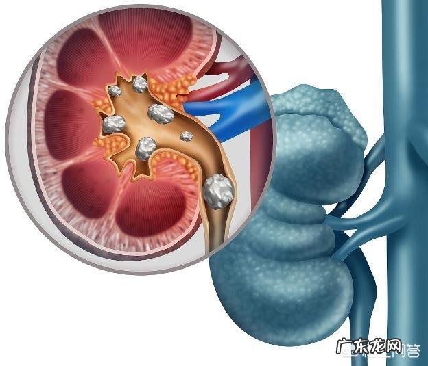 有哪些饮料会引起尿酸升高