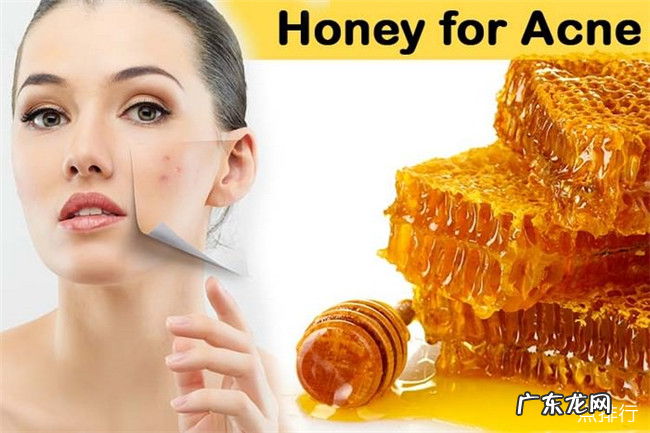 治疗痤疮的最好方法 10种治疗痤疮的方法