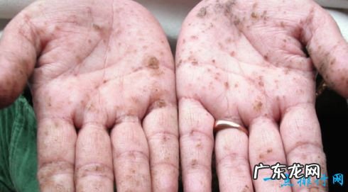 世界上最毒的物质 钋210毒性可怕