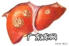 做什么检查可以发现早期肝癌