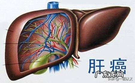 做什么检查可以发现早期肝癌