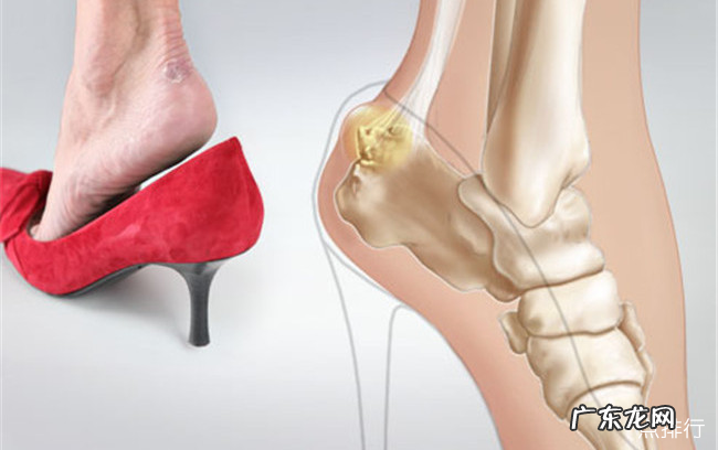 穿高跟鞋的十大弊端 经常穿高跟鞋的危害