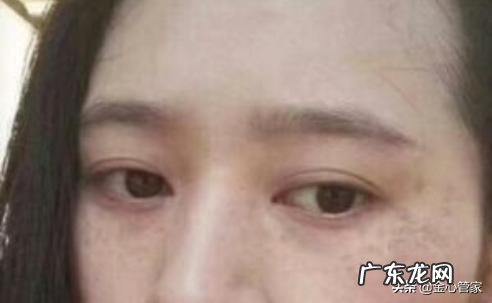 女性长斑的原因有哪些为什么有些八、九十岁的老年人不长老年斑