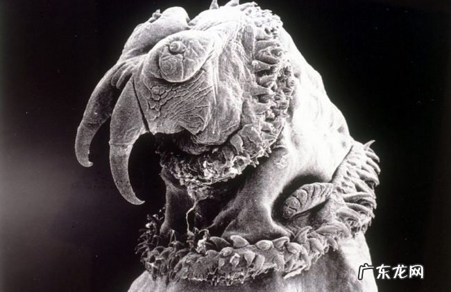 世界上十大最恶心的寄生虫 非常恶心恐怖