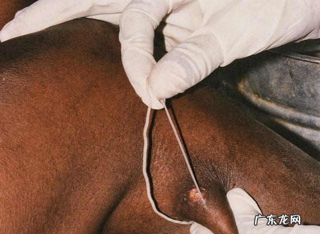 世界上十大最恶心的寄生虫 非常恶心恐怖