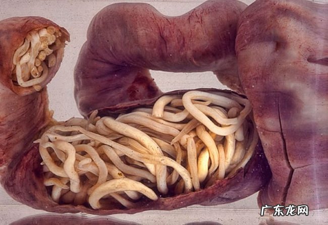 世界上十大最恶心的寄生虫 非常恶心恐怖