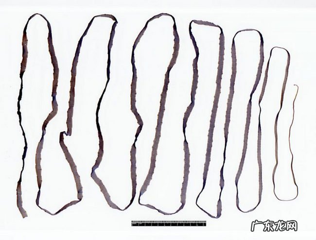 世界上十大最恶心的寄生虫 非常恶心恐怖