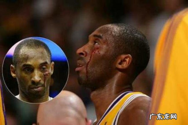 Nba十大打架事件 最严重的被凑出了脑浆