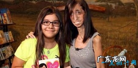 世界上最瘦的人体重只有27公斤