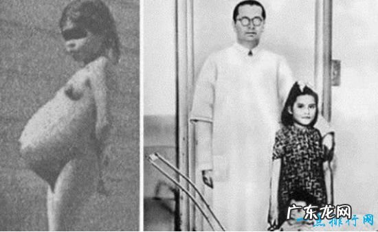 盘点世界上最小的人 最矮小的马加尔竟只有9斤重