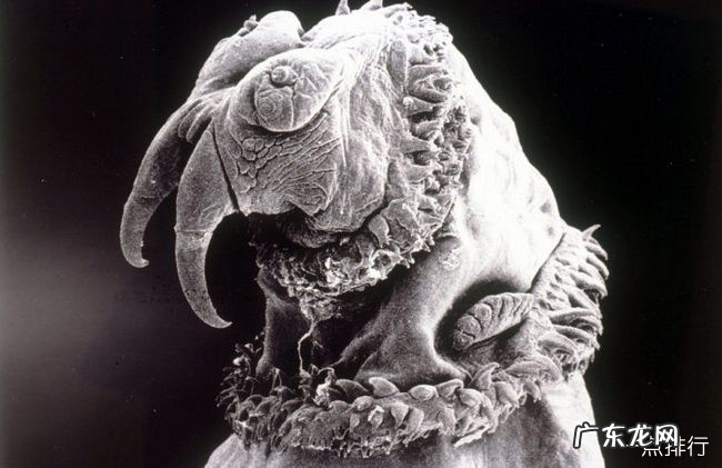 全球十大最恐怖的寄生虫 胆小勿入真的很渗人