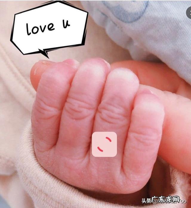 剖腹产后刀疤增生能修复吗月子期如何减掉大肚子