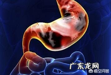 什么是急性胃炎?