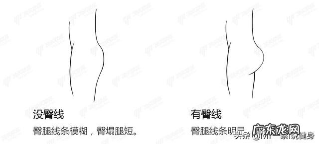 臀部两边凹进去,不美观,怎么办