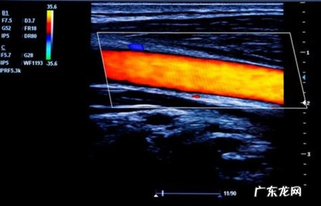 50岁的女士怎么保养身体
