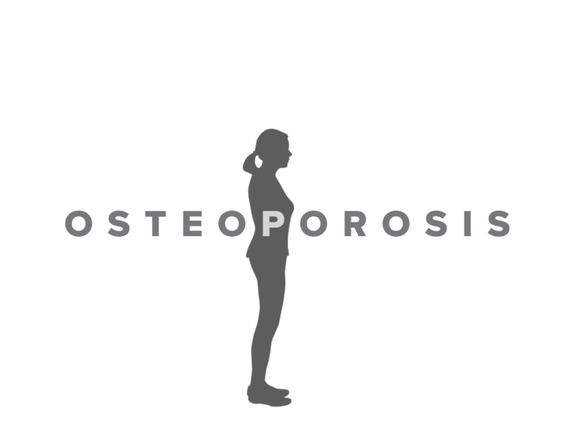 50岁的女士怎么保养身体