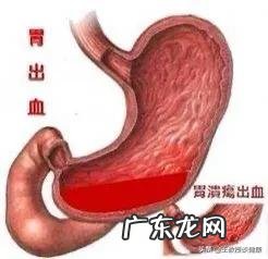 奉行素食主义的乔布斯罹患癌症,这给了我们什么启示