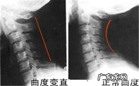 女人经常感觉头晕、没力气,有时还会脚麻,是怎么回事