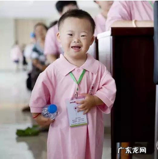 什么是唐氏综合征呢?治疗的好吗?