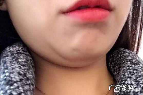 怎样减掉下巴上的赘肉?