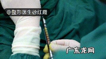 怎样减掉下巴上的赘肉?