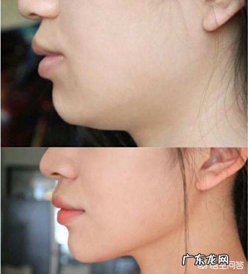 怎样减掉下巴上的赘肉?