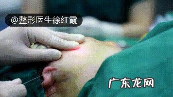 怎样减掉下巴上的赘肉?