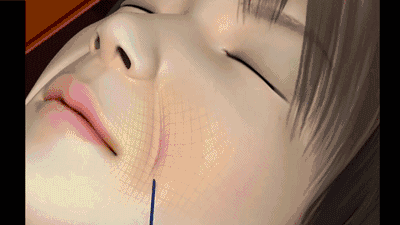 解决皮肤松弛的方法有哪些