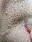 脸部太干怎么化妆都浮粉