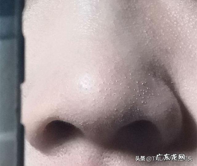 脸部太干怎么化妆都浮粉