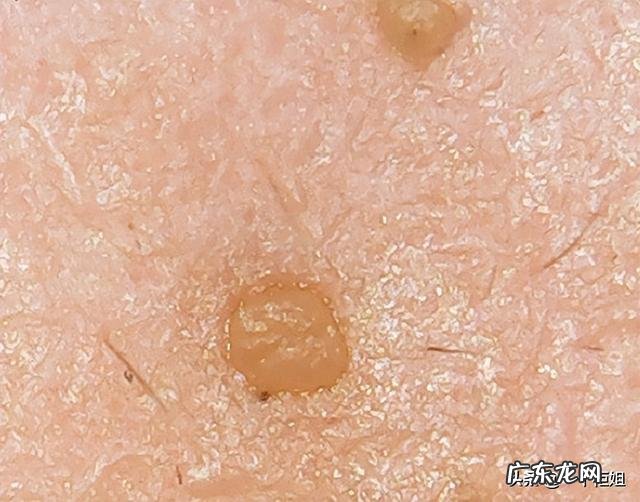 脸部太干怎么化妆都浮粉