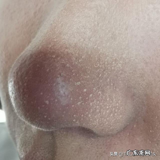 脸部太干怎么化妆都浮粉