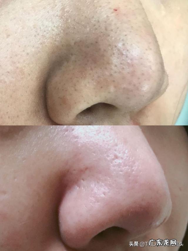 脸部太干怎么化妆都浮粉