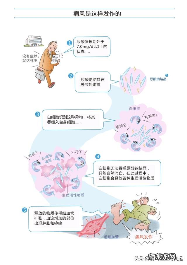 为什么有人说菊苣可以缓解痛风真的有用吗