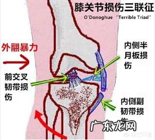 造成膝关节内侧副韧带扭伤的原因是什么其主要症状有哪些