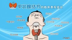 甲状腺结节不能吃的6种食物