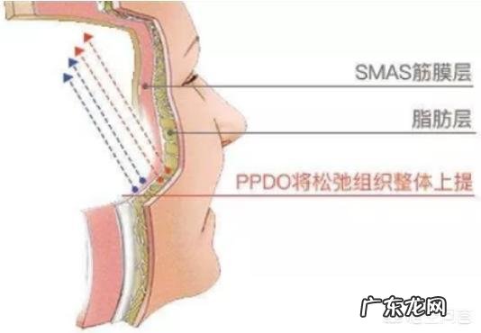 大V线雕做完之后多久才能再做下