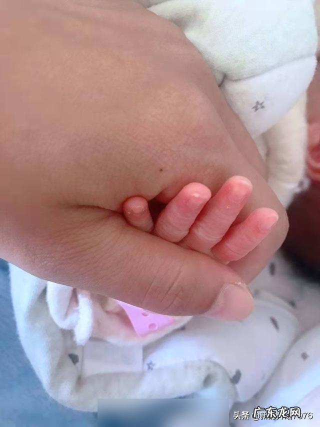 产后通乳过程中到底是热敷还是冷敷