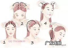 头发干枯有头屑脱发