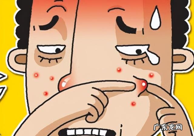 痤疮的中医辨证治疗医案