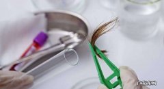 亲子鉴定要头发吗