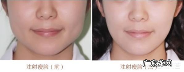 怎样做才能让脂肪脸和肌肉脸瘦下来