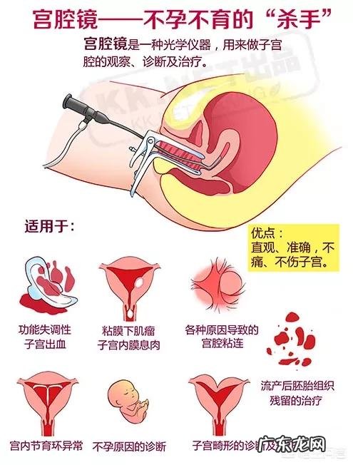 做宫腔镜手术后有什么注意事项