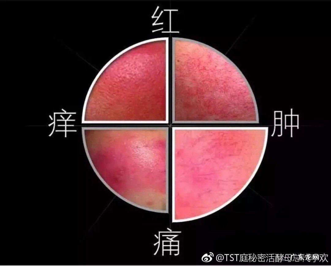 敏感性皮肤如何护理