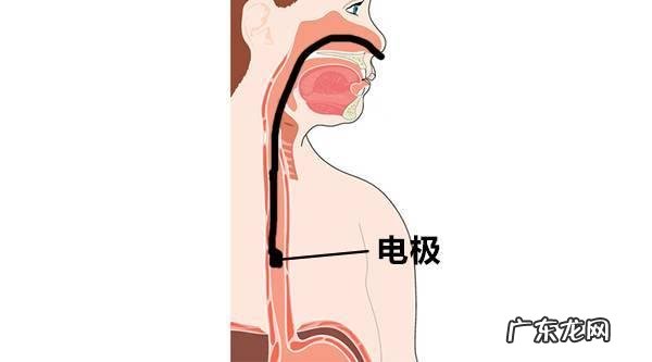 咽炎又犯了，比较严重，大家有没有zhi标又zhi本的好办法
